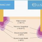 radiofrekwencja mikroigłowa bielsko