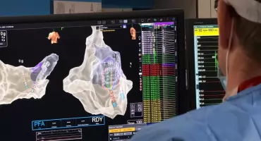 Najnowsza technologia ablacji dostępna dla pacjentów Szpitala Wojewódzkiego w Bielsku‑Białej